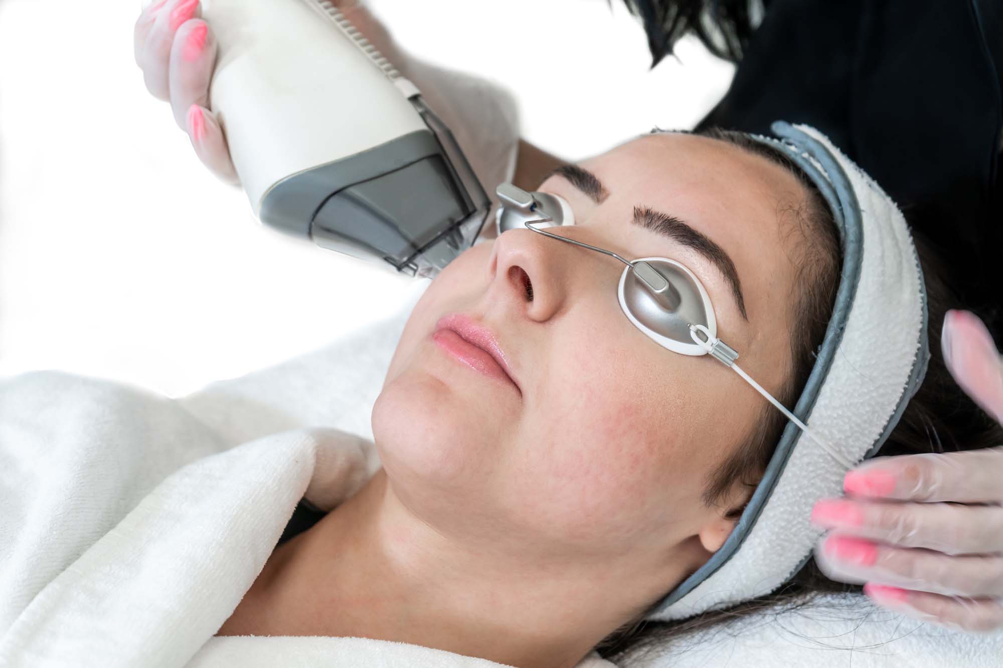 Close up of laser hand piece used for skin rejuvenation on woman's face, with beauty technician hands holding laser equipment in a medical spa. White background.