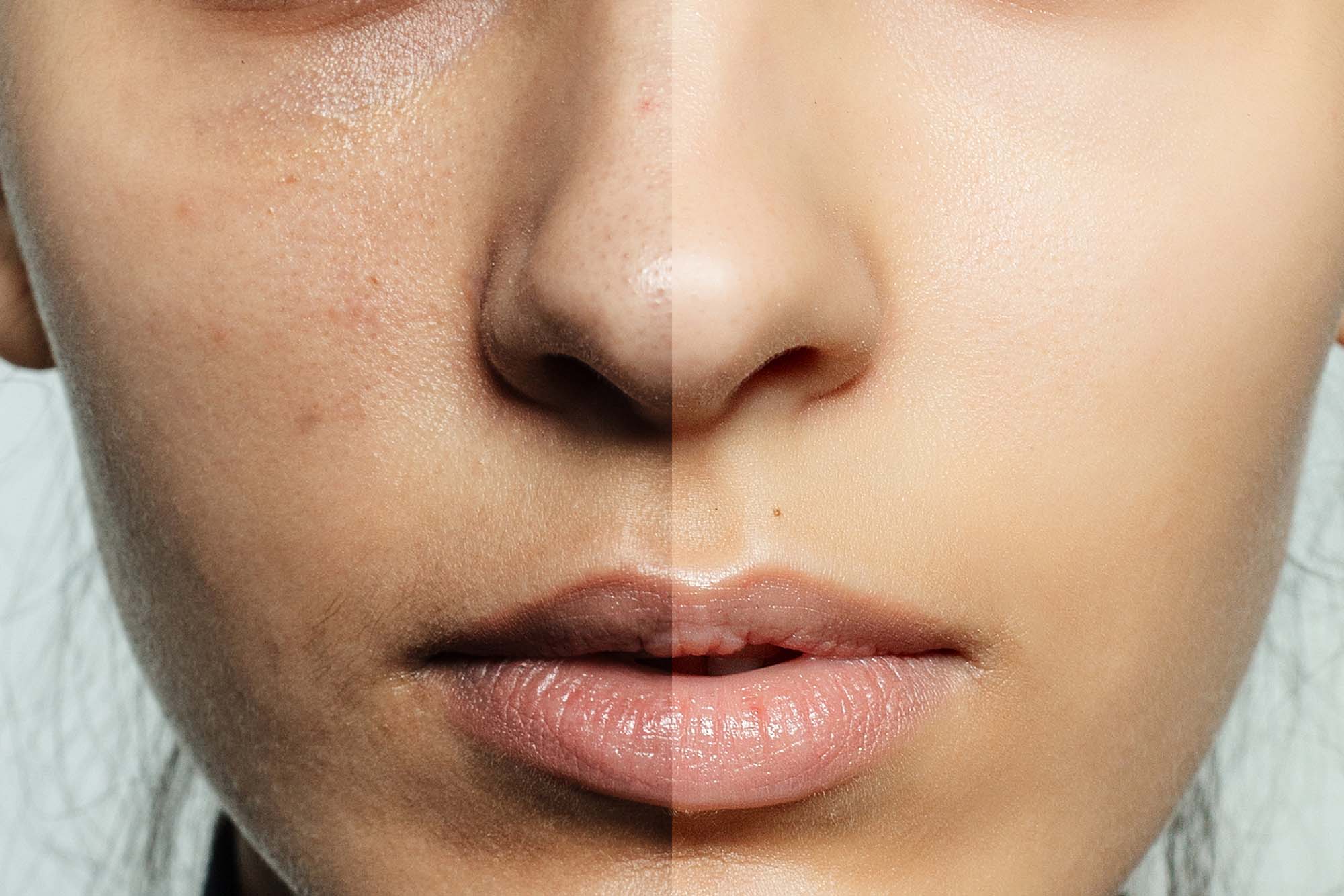 Before and after cosmetic operation. health, people, youth and beauty concept - Before and after cosmetic operation. Young pretty woman portrait. Before and after cosmetic or plastic procedure anti-age therapy, treatment