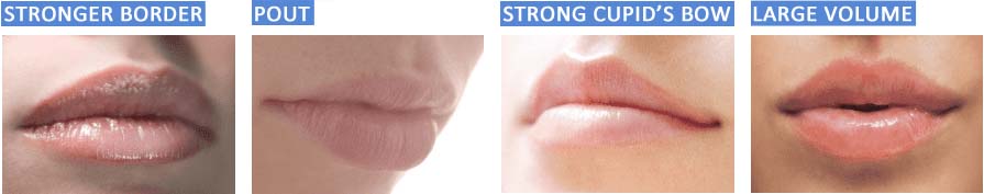 Filler injection for female Lips