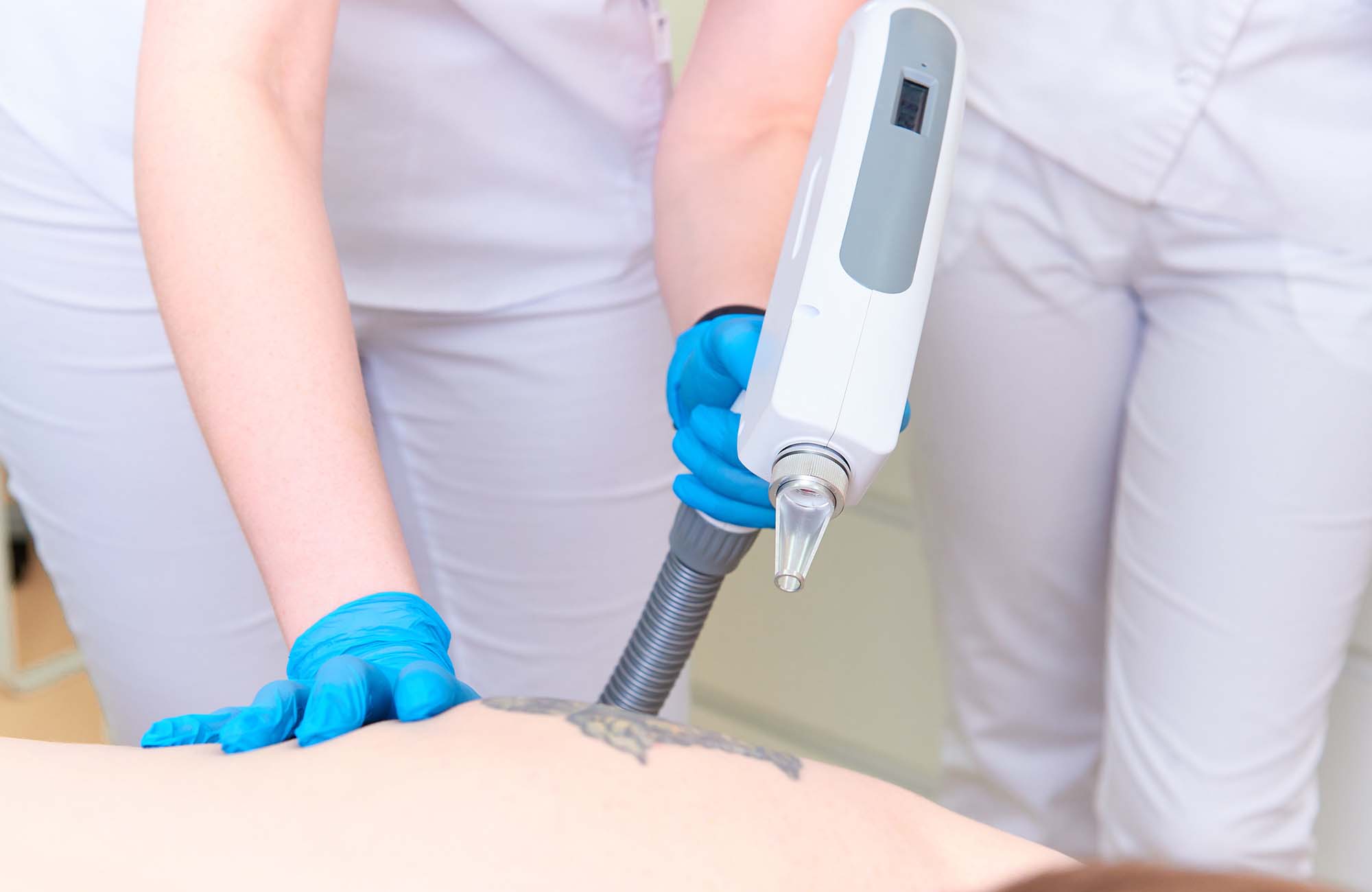 Procedure removal tattoo in laser cosmetology clinic. Procedure removal tattoo in laser cosmetology clinic.