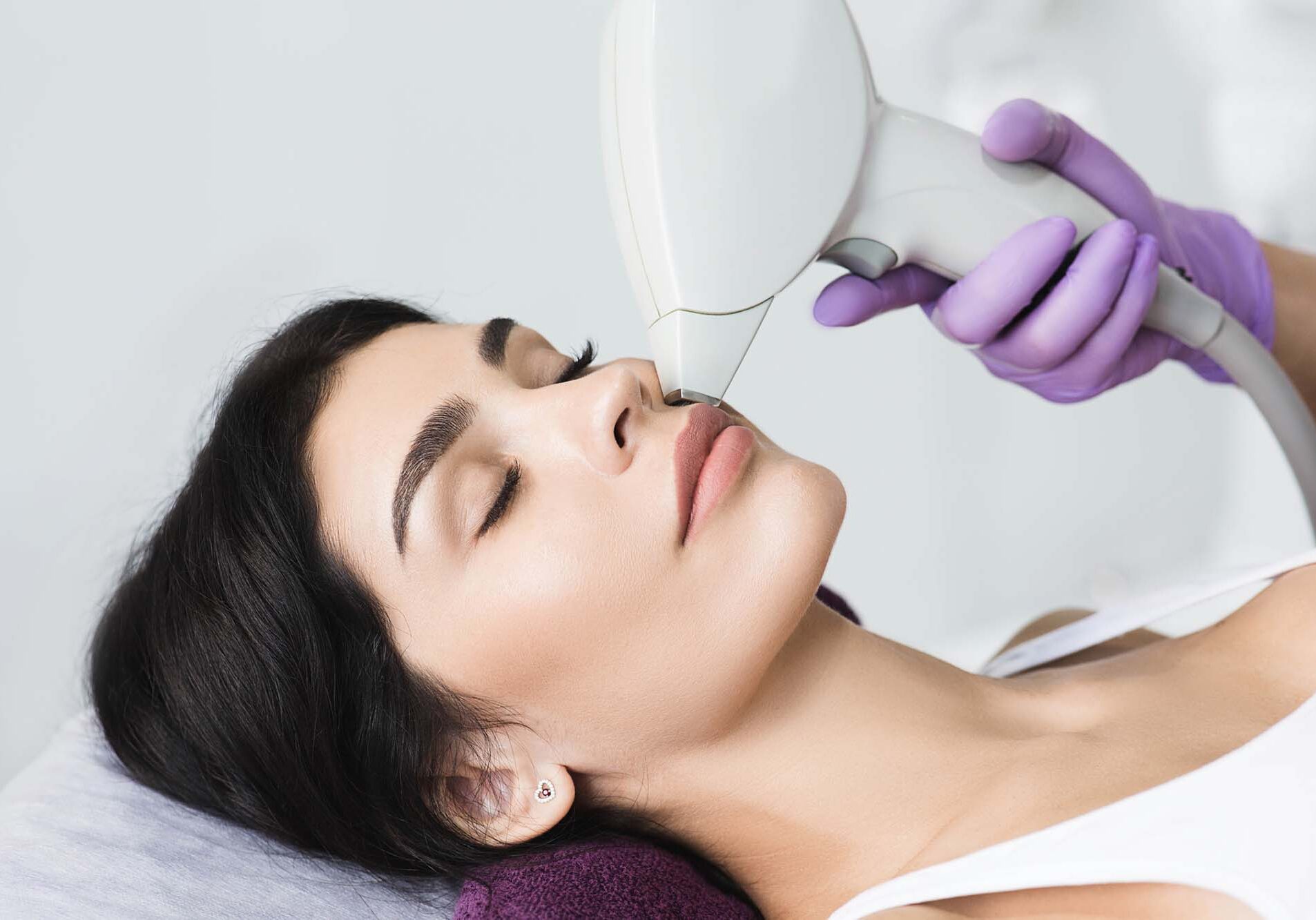 Pretty brunette woman getting hair removing on face. Procedure laser epilation at beauty studio Pretty brunette woman getting hair removing on face. Procedure laser epilation at beauty studio