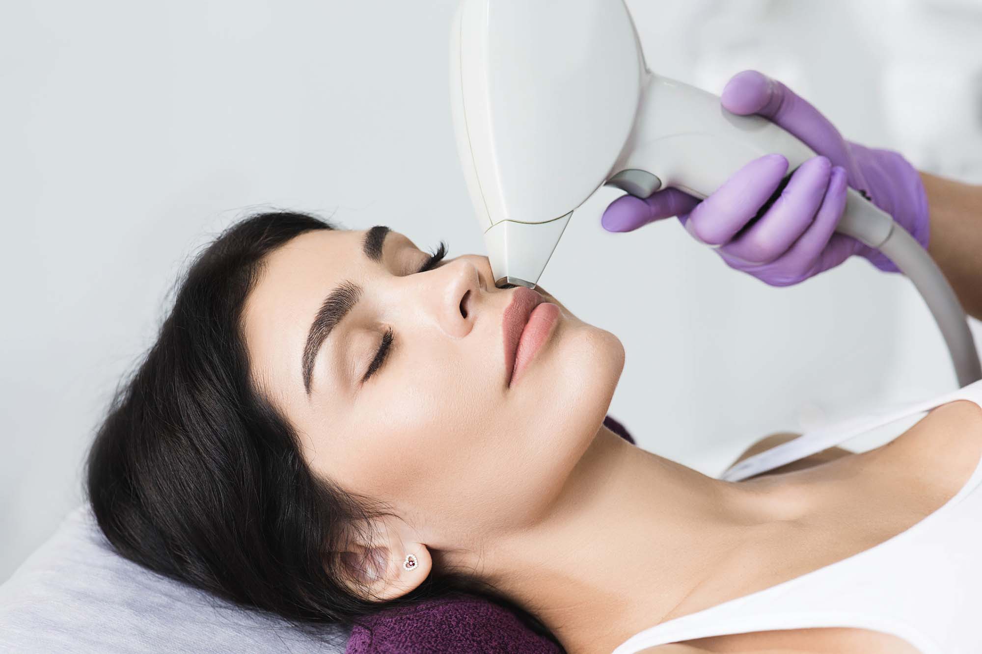 Pretty brunette woman getting hair removing on face. Procedure laser epilation at beauty studio